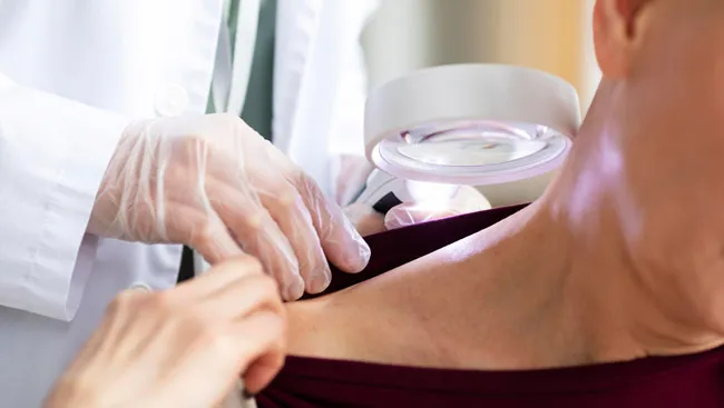 Qué es la psoriasis