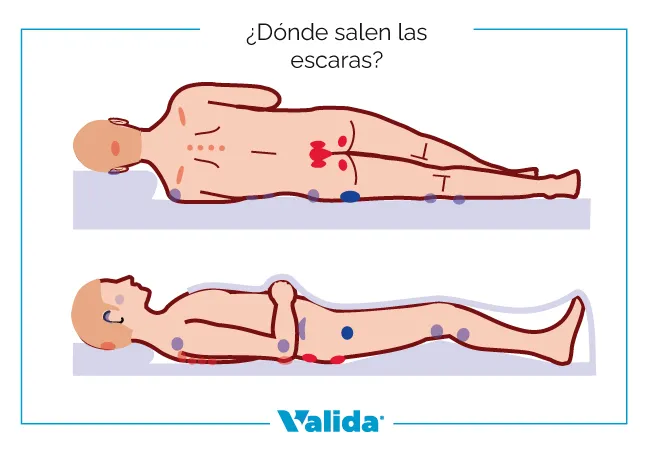 ¿Dónde salen las escaras?
