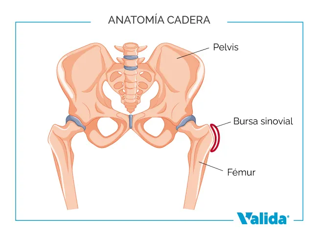 Bursitis de cadera