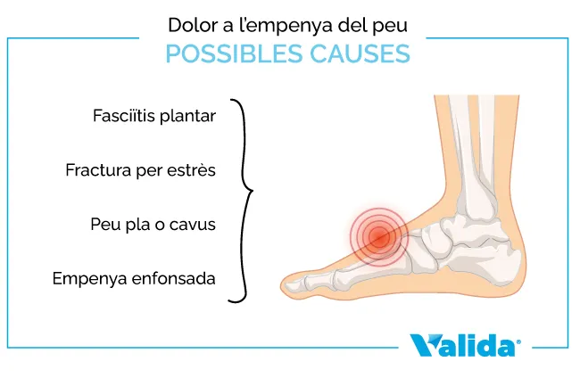 dolor a l'empenya del peu possibles causes fractura