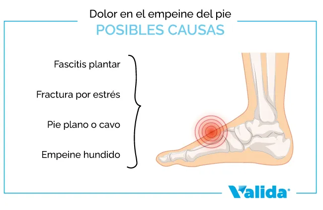 posibles causas del dolor en el empeine del pie