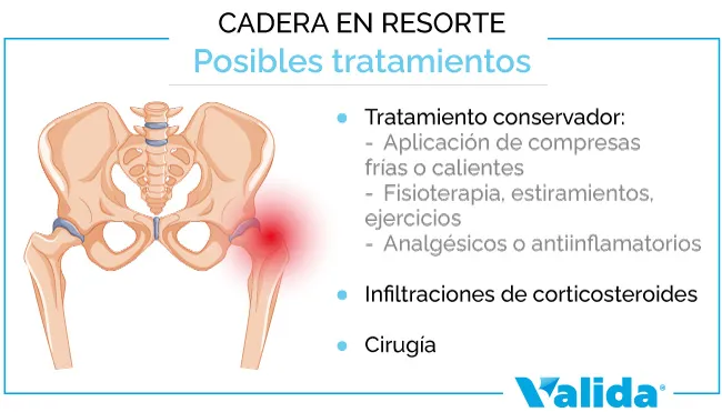 posibles tratamientos y curas para la cadera en resorte