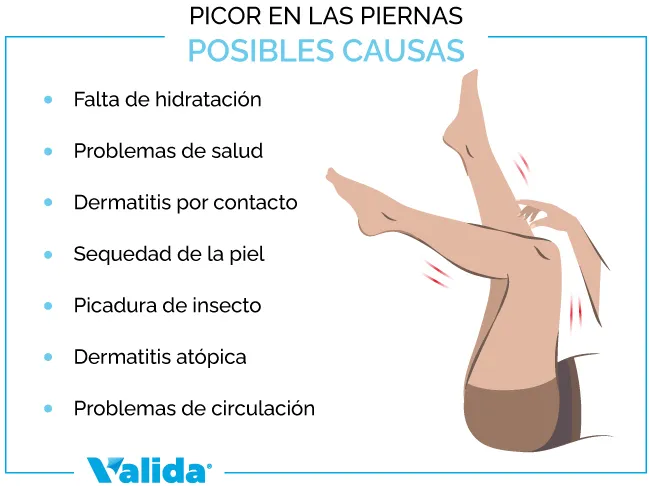 Posibles causas del picor de piernas