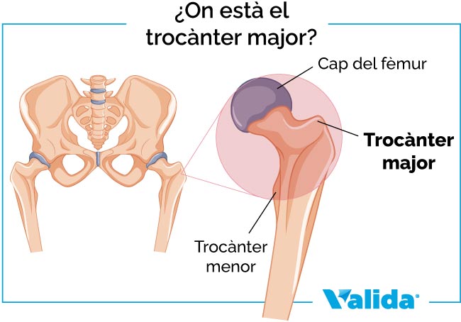 on està el trocànter major
