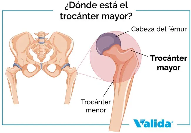 dónde está el trocánter mayor