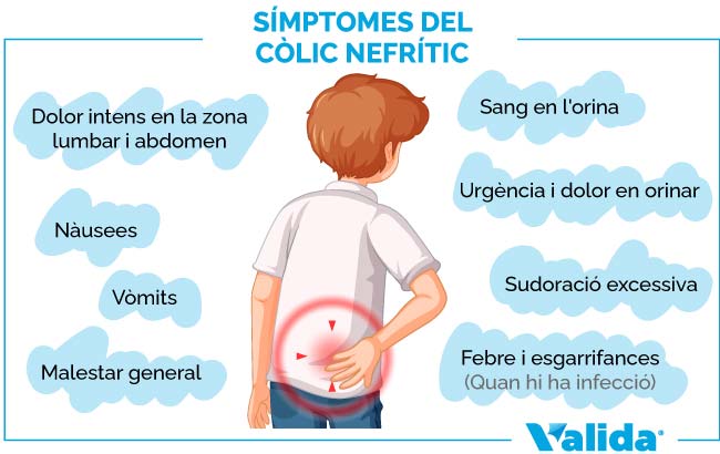 símptomes del còlic nefrític dolor intens nàusees i vòmits