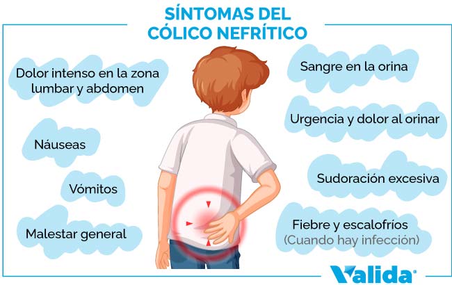 síntomas del cólico nefrítico náuseas y vómitos