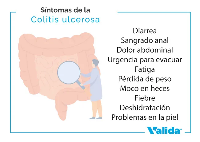 Síntomas de la colitis ulcerosa 