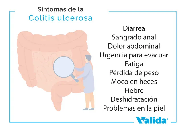 Síntomas de la colitis ulcerosa