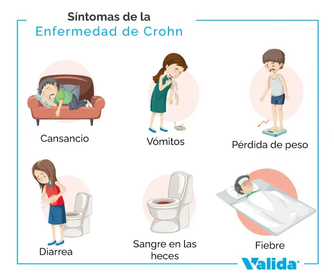 Síntomas de la enfermedad de Crohn