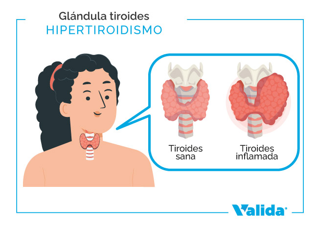 Anatomía de la glándula de tiroides.